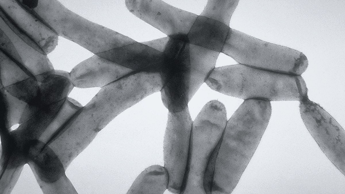 Bacterias Legionella pneumophila con forma de bastón vistas al microscopio electrónico de transmisión